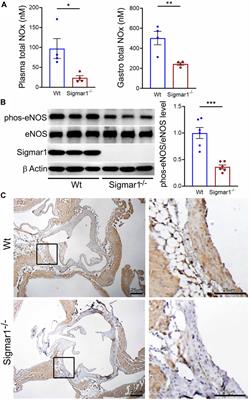 Deletion of Sigmar1 leads to increased arterial stiffness and altered mitochondrial respiration resulting in vascular dysfunction